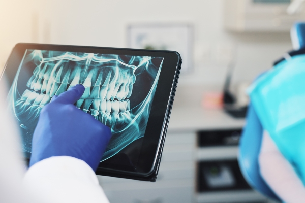Find A Dentist Near Me For Dental Implants