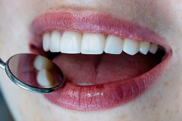 Find A Dentist Near Me For Smile Restorations