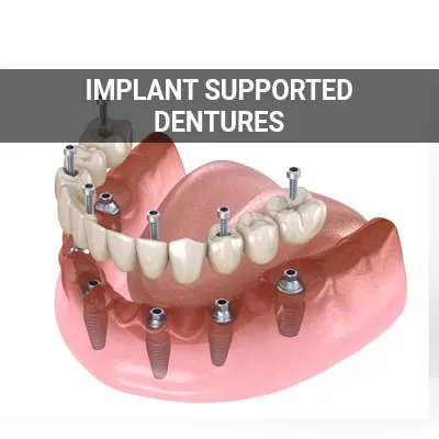 Visit our Implant Supported Dentures page