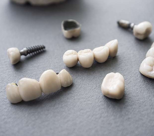 Troy The Difference Between Dental Implants and Mini Dental Implants